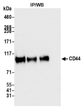 Rabbit anti-CD44 Recombinant Monoclonal Antibody [BLR038F]
