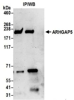 Rabbit anti-ARHGAP5 Antibody, Affinity Purified