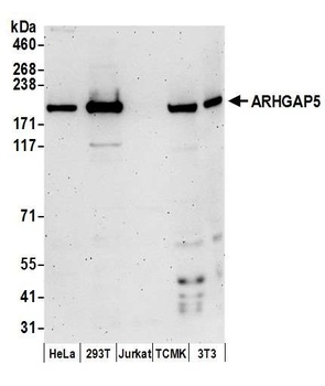 Rabbit anti-ARHGAP5 Antibody, Affinity Purified