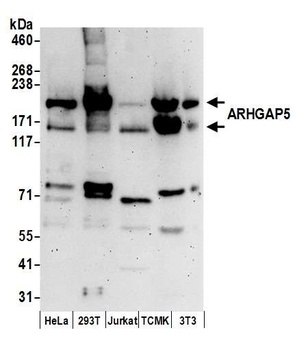 Rabbit anti-ARHGAP5 Antibody, Affinity Purified