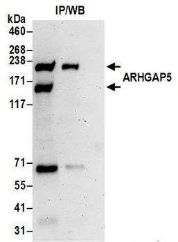 Rabbit anti-ARHGAP5 Antibody, Affinity Purified
