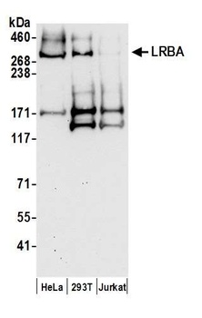 Rabbit anti-LRBA Antibody, Affinity Purified