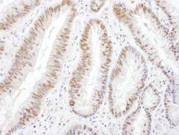 Goat anti-BRG1/SMARCA4 Antibody, Affinity Purified