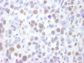 Goat anti-BRG1/SMARCA4 Antibody, Affinity Purified