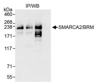 Rabbit anti-SMARCA2/BRM Antibody, Affinity Purified