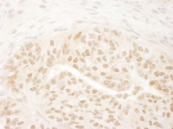 Rabbit anti-DOT1L Antibody, Affinity Purified