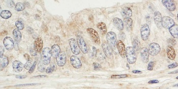 Rabbit anti-Sin1 Antibody, Affinity Purified