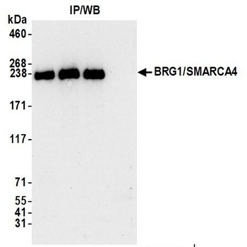 Rabbit anti-BRG1/SMARCA4 Antibody, Affinity Purified