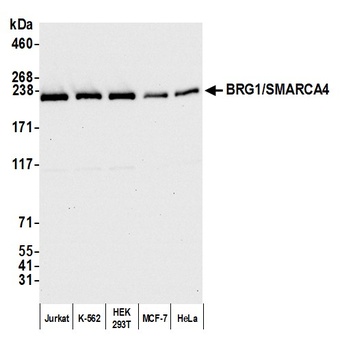 Rabbit anti-BRG1/SMARCA4 Antibody, Affinity Purified