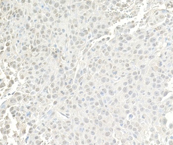 Rabbit anti-BRG1/SMARCA4 Antibody, Affinity Purified