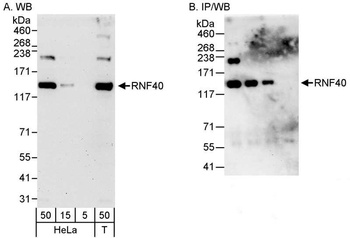 Rabbit anti-RNF40 Antibody, Affinity Purified