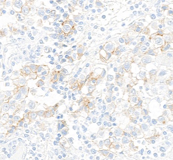 Rabbit anti-c-Kit Recombinant Monoclonal Antibody [BLR263L]