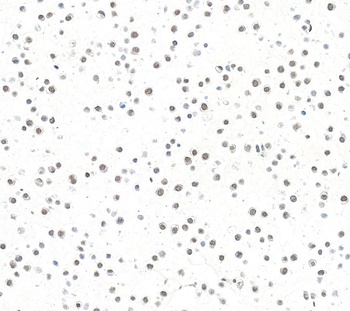 Rabbit anti-ARID1B Recombinant Monoclonal Antibody [BLR291L]