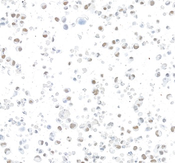 Rabbit anti-ARID1B Recombinant Monoclonal Antibody [BLR291L]