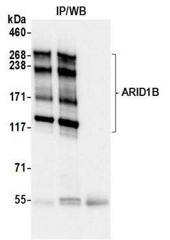 Rabbit anti-ARID1B Recombinant Monoclonal Antibody [BLR291L]