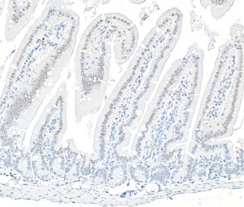 Rabbit anti-ARID1B Recombinant Monoclonal Antibody [BLR291L]