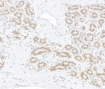 Rabbit anti-ARID1B Recombinant Monoclonal Antibody [BLR291L]