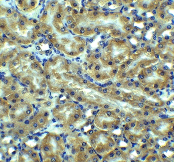 DR5 Antibody