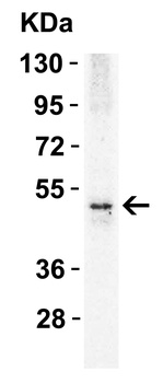 DR5 Antibody