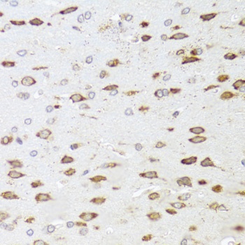 ARHGAP5 Antibody