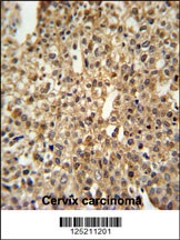 DEN1A Antibody