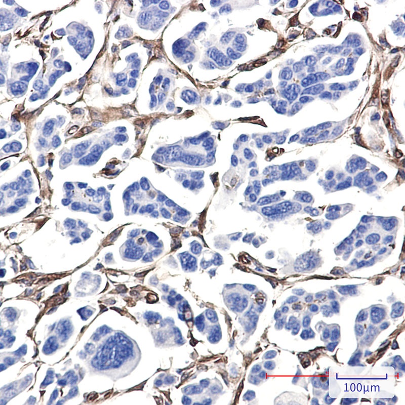 Fascin Rabbit pAb