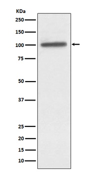 alpha Actinin 4 ACTN4 Monoclonal Antibody