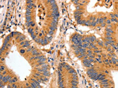 BAIAP2 Antibody