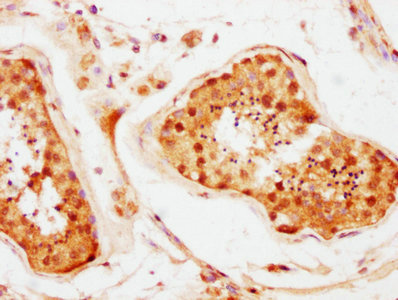 BRD1 Antibody