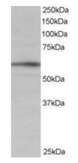 BAIAP2 (isoform 1) Antibody