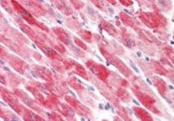 Cofilin 2 (muscle) Antibody