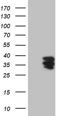 CD39 Antibody