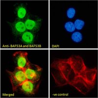 BAF53A and BAF53B Antibody