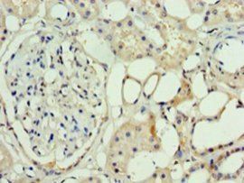 ASH2L Antibody
