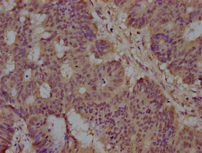 ST5 Antibody