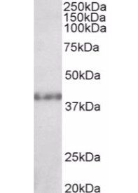 SUV39H2 Antibody