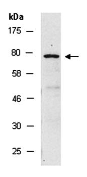 TACR1 (C1) Antibody, Rabbit Polyclonal