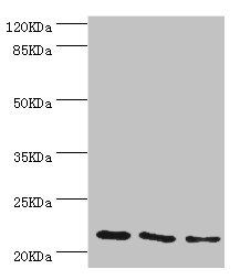 TAGLN2 Antibody