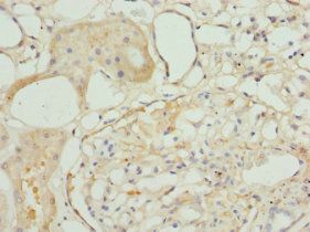 TAGLN2 Antibody
