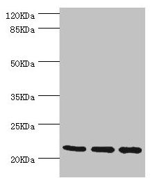 TAGLN2 Antibody