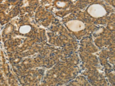 TAGLN2 Antibody
