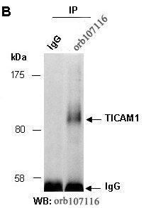 TICAM1 (N) Antibody, Rabbit Polyclonal
