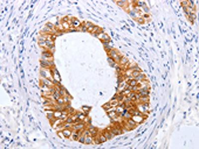 TNFAIP1 Antibody