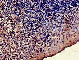 TRADD Antibody