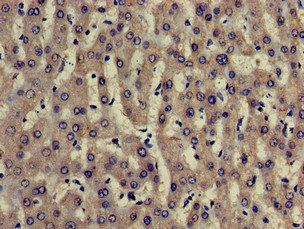 TRADD Antibody