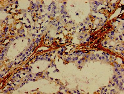 TNF Antibody