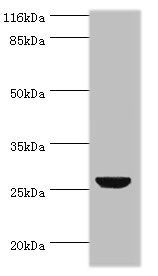 TNF Antibody